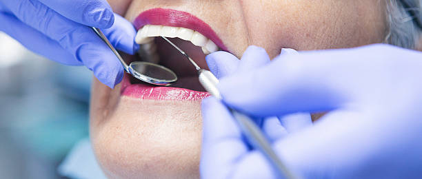 Best Cracked Tooth Emergency Dentist  in Butler, AL